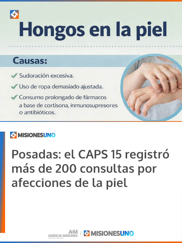 Posadas: el CAPS 15 registró más de 200 consultas por afecciones de la piel