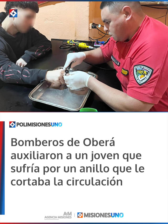 Bomberos de Oberá auxiliaron a un joven que sufría por un anillo que le cortaba la circulación